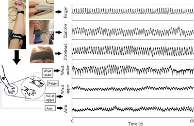 Toward Accurate Extraction of Respiratory Frequency From the Photoplethysmogram: Effect of Measurement Site